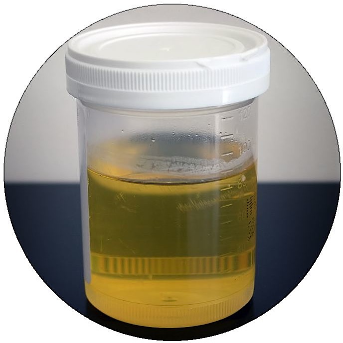 Urine Sample Pinback Button and Stickers