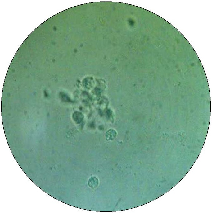 Urine Sample Pinback Button and Stickers